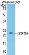 Toll Like Receptor 3 antibody, LS-C296697, Lifespan Biosciences, Western Blot image 