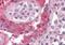 SET Nuclear Proto-Oncogene antibody, orb18339, Biorbyt, Immunohistochemistry paraffin image 