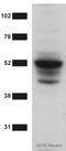 TNF Receptor Superfamily Member 1A antibody, ab19139, Abcam, Western Blot image 