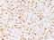 DNA Topoisomerase II Alpha antibody, 33-788, ProSci, Immunohistochemistry frozen image 