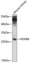 Homeobox B9 antibody, 13-514, ProSci, Western Blot image 