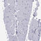Cadherin Related Family Member 3 antibody, HPA011218, Atlas Antibodies, Immunohistochemistry paraffin image 