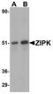 Death Associated Protein Kinase 3 antibody, NBP1-76962, Novus Biologicals, Western Blot image 