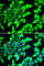 Histone Deacetylase 5 antibody, A7189, ABclonal Technology, Immunofluorescence image 
