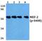 Myocyte Enhancer Factor 2A antibody, PA5-36665, Invitrogen Antibodies, Western Blot image 
