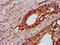 Protein Tyrosine Phosphatase Non-Receptor Type 3 antibody, LS-C671033, Lifespan Biosciences, Immunohistochemistry paraffin image 