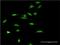 SWI/SNF Related, Matrix Associated, Actin Dependent Regulator Of Chromatin, Subfamily A, Member 5 antibody, H00008467-M02, Novus Biologicals, Immunocytochemistry image 