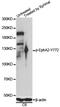 EPH Receptor A2 antibody, LS-C750623, Lifespan Biosciences, Western Blot image 
