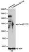 Ephrin type-A receptor 2 antibody, LS-C750623, Lifespan Biosciences, Western Blot image 