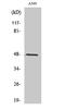 Protein Serine Kinase H1 antibody, STJ95248, St John