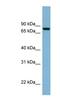 Neurochondrin antibody, NBP1-55390, Novus Biologicals, Western Blot image 