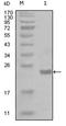 IKK alpha/beta antibody, AM06253SU-N, Origene, Western Blot image 