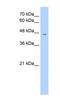 Rh Associated Glycoprotein antibody, NBP1-62670, Novus Biologicals, Western Blot image 