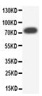 ATP Binding Cassette Subfamily G Member 2 (Junior Blood Group) antibody, PA1387, Boster Biological Technology, Western Blot image 