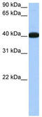 NOP56 Ribonucleoprotein antibody, TA345961, Origene, Western Blot image 