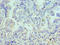 Lymphatic Vessel Endothelial Hyaluronan Receptor 1 antibody, LS-C380433, Lifespan Biosciences, Immunohistochemistry paraffin image 