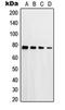 Protein Kinase C Delta antibody, orb214441, Biorbyt, Western Blot image 