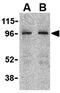 Nucleotide Binding Oligomerization Domain Containing 2 antibody, GTX31665, GeneTex, Western Blot image 