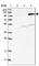 LEM Domain Containing 3 antibody, HPA025078, Atlas Antibodies, Western Blot image 