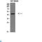 Corticotropin Releasing Hormone Receptor 2 antibody, LS-C813826, Lifespan Biosciences, Western Blot image 