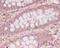 Myosin light chain kinase, smooth muscle antibody, M01697, Boster Biological Technology, Immunohistochemistry frozen image 