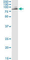 MutY DNA Glycosylase antibody, LS-C197721, Lifespan Biosciences, Immunoprecipitation image 