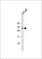 NK3 Homeobox 1 antibody, GTX80628, GeneTex, Western Blot image 
