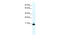 Transcription Factor 21 antibody, 27-860, ProSci, Enzyme Linked Immunosorbent Assay image 