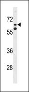 Kelch Like Family Member 38 antibody, 58-746, ProSci, Western Blot image 
