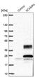 Secretory Carrier Membrane Protein 4 antibody, PA5-60309, Invitrogen Antibodies, Western Blot image 