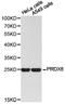Peroxiredoxin 5 antibody, LS-C192951, Lifespan Biosciences, Western Blot image 