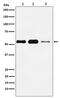 Patatin Like Phospholipase Domain Containing 2 antibody, M01800, Boster Biological Technology, Western Blot image 