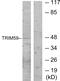 Tripartite Motif Containing 59 antibody, GTX87419, GeneTex, Western Blot image 