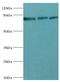 Enhancer Of Zeste 1 Polycomb Repressive Complex 2 Subunit antibody, LS-C378991, Lifespan Biosciences, Western Blot image 