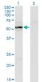 UDP-N-Acetylglucosamine Pyrophosphorylase 1 antibody, H00006675-M01, Novus Biologicals, Western Blot image 