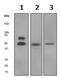 Calcium/Calmodulin Dependent Protein Kinase II Alpha antibody, ab92332, Abcam, Western Blot image 