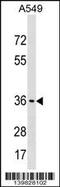 ADP-Ribosyltransferase 5 antibody, 60-180, ProSci, Western Blot image 