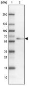 Tubulin Tyrosine Ligase Like 11 antibody, NBP2-14495, Novus Biologicals, Western Blot image 