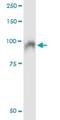 Slingshot Protein Phosphatase 3 antibody, H00054961-M01, Novus Biologicals, Immunoprecipitation image 