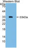 SMAD Family Member 6 antibody, MBS2028496, MyBioSource, Western Blot image 