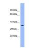 Pregnancy Specific Beta-1-Glycoprotein 5 antibody, NBP1-57962, Novus Biologicals, Western Blot image 