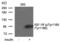 Insulin Like Growth Factor 1 Receptor antibody, PA5-37602, Invitrogen Antibodies, Western Blot image 