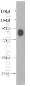 Myristoylated Alanine Rich Protein Kinase C Substrate antibody, 10004-2-Ig, Proteintech Group, Western Blot image 