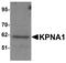 Karyopherin Subunit Alpha 1 antibody, LS-C115908, Lifespan Biosciences, Western Blot image 