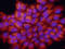 S100 Calcium Binding Protein A8 antibody, AF3059, R&D Systems, Immunocytochemistry image 