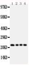 Fibroblast Growth Factor 22 antibody, GTX11704, GeneTex, Western Blot image 