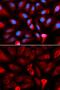 FKBP Prolyl Isomerase 4 antibody, GTX64678, GeneTex, Immunofluorescence image 