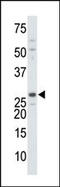 Deoxythymidylate Kinase antibody, 62-626, ProSci, Western Blot image 