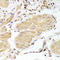 Caspase 2 antibody, STJ28291, St John