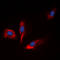 Insulin Like Growth Factor Binding Protein 1 antibody, abx121940, Abbexa, Western Blot image 